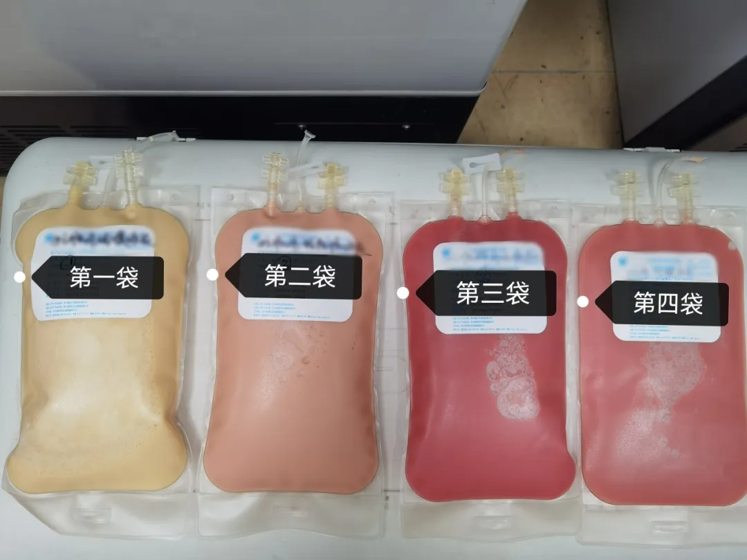 亨特・大医同行计划|滕本秀教授 配图 8