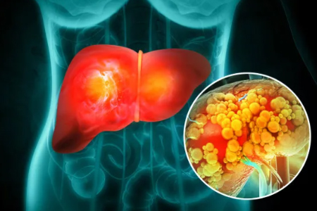 全国爱肝日，健康长寿的关键一环，守护人体“化工厂”——肝脏。