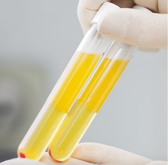 好的血液医学抗衰实验可以提供哪些服务项目