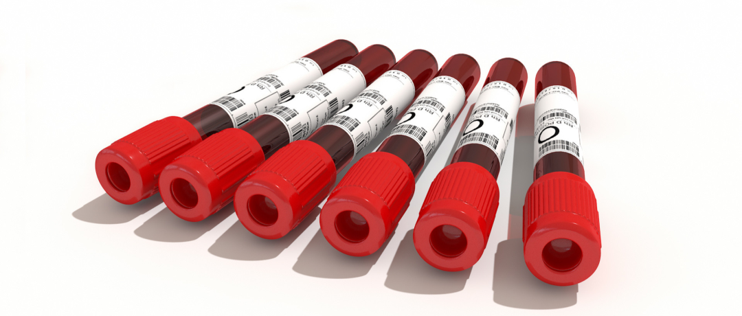 疾病科普|糖尿病不容忽视的并发症：大血管病变